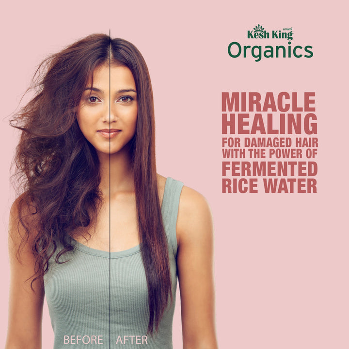 Kesh King Organics Anti Frizz Shampoo with Fermented Rice Water | For Dry & Frizzy Hair | 300ml